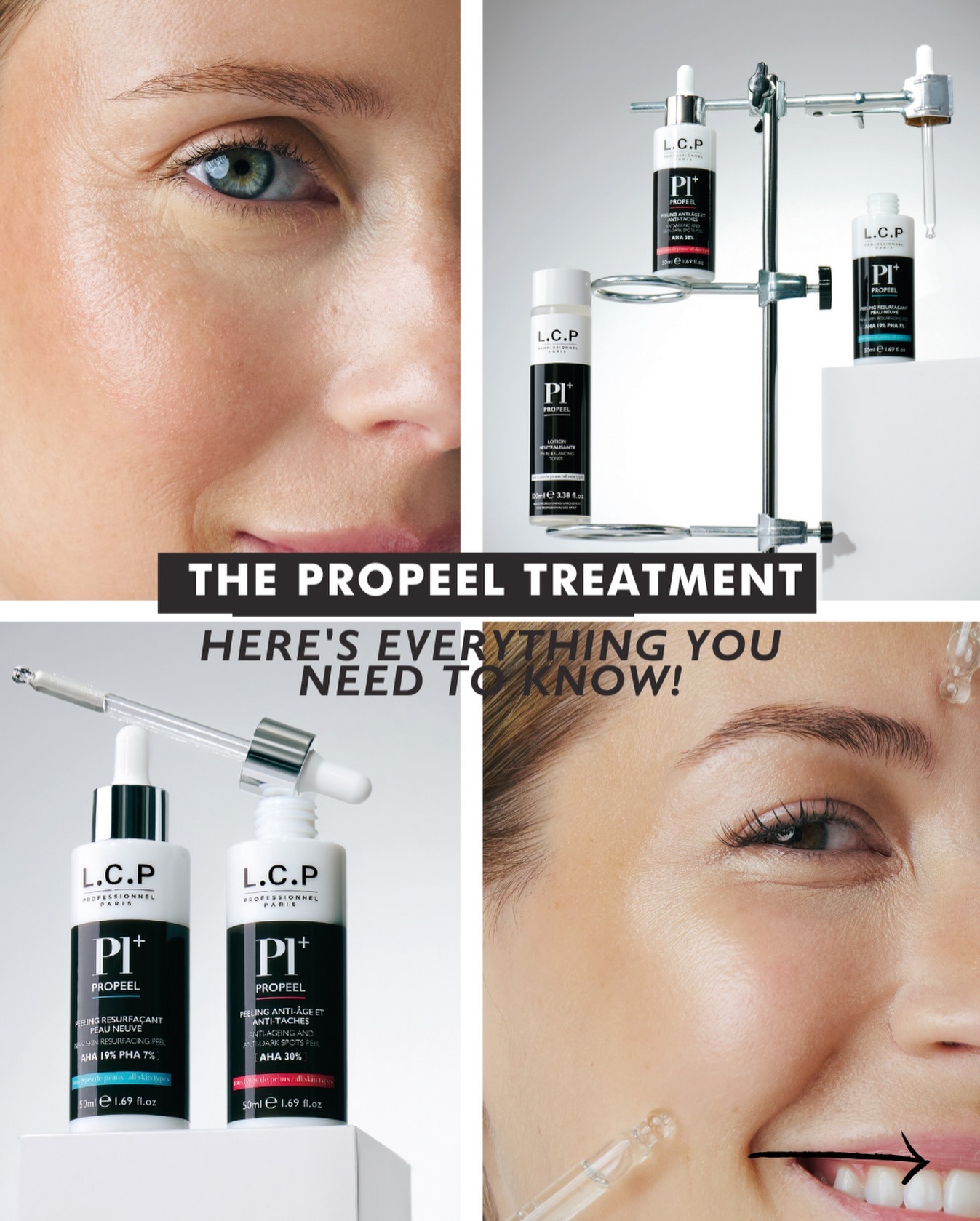 Chemical Peel